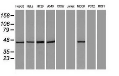 Anti-Cytokeratin 18 antibody [5E8] used in Western Blot (WB). GTX84255
