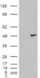 Anti-Cytokeratin 18 antibody [5E8] used in Western Blot (WB). GTX84255