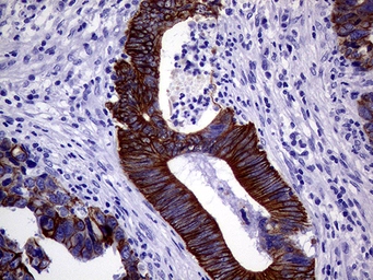 Anti-Cytokeratin 18 antibody [1E1] used in IHC (Paraffin sections) (IHC-P). GTX84256