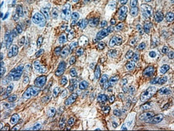 Anti-Cytokeratin 18 antibody [1E1] used in IHC (Paraffin sections) (IHC-P). GTX84256