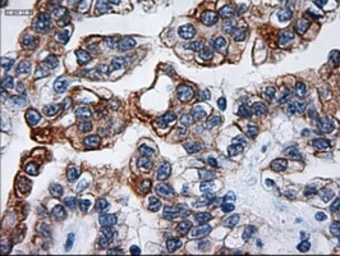 Anti-Cytokeratin 18 antibody [1E1] used in IHC (Paraffin sections) (IHC-P). GTX84256