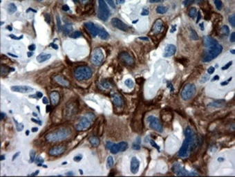 Anti-Cytokeratin 18 antibody [1E1] used in IHC (Paraffin sections) (IHC-P). GTX84256