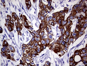 Anti-Cytokeratin 18 antibody [1E1] used in IHC (Paraffin sections) (IHC-P). GTX84256