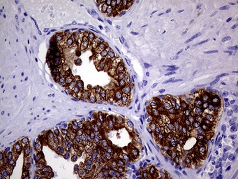 Anti-Cytokeratin 18 antibody [1E1] used in IHC (Paraffin sections) (IHC-P). GTX84256