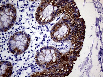 Anti-Cytokeratin 18 antibody [1E1] used in IHC (Paraffin sections) (IHC-P). GTX84256