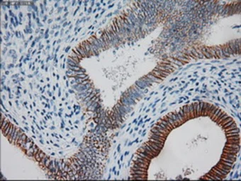 Anti-Cytokeratin 18 antibody [1E1] used in IHC (Paraffin sections) (IHC-P). GTX84256