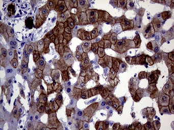 Anti-Cytokeratin 18 antibody [1E1] used in IHC (Paraffin sections) (IHC-P). GTX84256