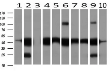 Anti-Cytokeratin 18 antibody [1E1] used in Western Blot (WB). GTX84256