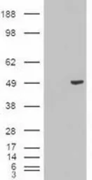 Anti-Cytokeratin 18 antibody [1E1] used in Western Blot (WB). GTX84256