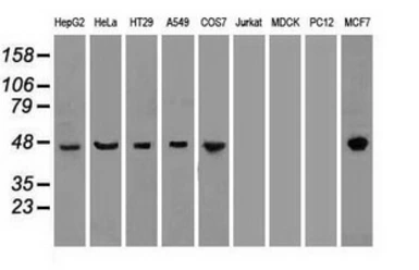 Anti-Cytokeratin 18 antibody [1E1] used in Western Blot (WB). GTX84256