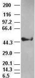 Anti-Cytokeratin 18 antibody [1E1] used in Western Blot (WB). GTX84256