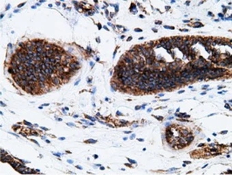 Anti-Ketohexokinase antibody [3D1] used in IHC (Paraffin sections) (IHC-P). GTX84277
