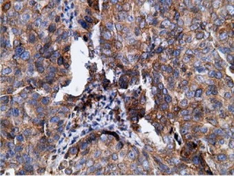 Anti-Ketohexokinase antibody [3D1] used in IHC (Paraffin sections) (IHC-P). GTX84277