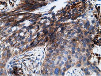 Anti-Ketohexokinase antibody [3D1] used in IHC (Paraffin sections) (IHC-P). GTX84277
