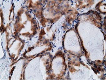 Anti-Ketohexokinase antibody [3D1] used in IHC (Paraffin sections) (IHC-P). GTX84277