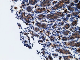 Anti-Ketohexokinase antibody [3D1] used in IHC (Paraffin sections) (IHC-P). GTX84277