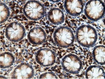 Anti-Ketohexokinase antibody [3D1] used in IHC (Paraffin sections) (IHC-P). GTX84277