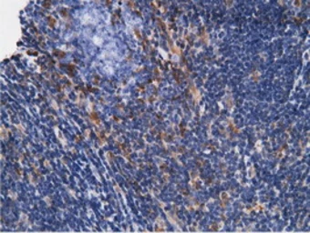 Anti-Ketohexokinase antibody [3D1] used in IHC (Paraffin sections) (IHC-P). GTX84277