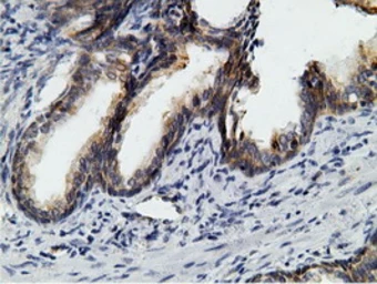 Anti-Ketohexokinase antibody [3D1] used in IHC (Paraffin sections) (IHC-P). GTX84277