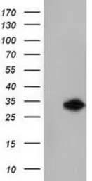 Anti-Ketohexokinase antibody [3D1] used in Western Blot (WB). GTX84277