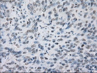 Anti-KDM4C antibody [5B9] used in IHC (Paraffin sections) (IHC-P). GTX84280