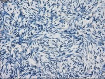 Anti-KDM4C antibody [5B9] used in IHC (Paraffin sections) (IHC-P). GTX84280