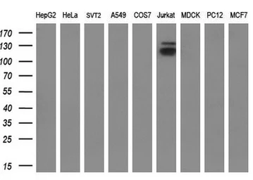 Anti-KDM4C antibody [5B9] used in Western Blot (WB). GTX84280