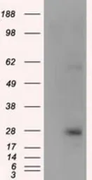 Anti-KCTD5 antibody [3C8] used in Western Blot (WB). GTX84281