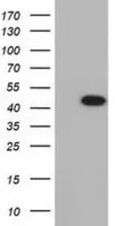 Anti-IVD antibody [5A11] used in Western Blot (WB). GTX84284