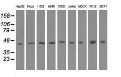 Anti-IVD antibody [5A11] used in Western Blot (WB). GTX84284