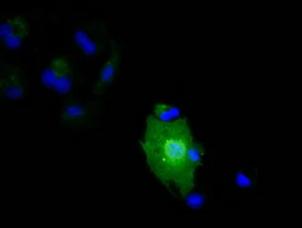 Anti-IL1F6 antibody [3A2] used in Immunocytochemistry/ Immunofluorescence (ICC/IF). GTX84297