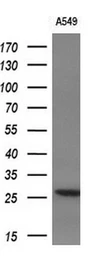 Anti-IL1F6 antibody [3A2] used in Western Blot (WB). GTX84297