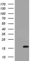 Anti-IL1F6 antibody [3A2] used in Western Blot (WB). GTX84297