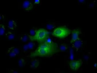 Anti-IFIT1 antibody [3G8] used in Immunocytochemistry/ Immunofluorescence (ICC/IF). GTX84315