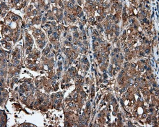 Anti-IFIT1 antibody [3G8] used in IHC (Paraffin sections) (IHC-P). GTX84315