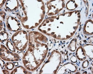 Anti-IFIT1 antibody [3G8] used in IHC (Paraffin sections) (IHC-P). GTX84315