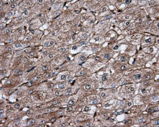Anti-IFIT1 antibody [3G8] used in IHC (Paraffin sections) (IHC-P). GTX84315