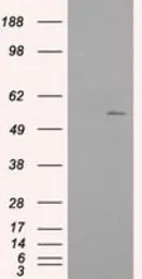 Anti-IFIT1 antibody [3G8] used in Western Blot (WB). GTX84315