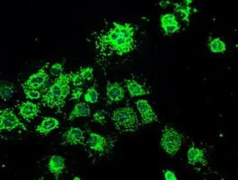 Anti-Grp75 antibody [9F8] used in Immunocytochemistry/ Immunofluorescence (ICC/IF). GTX84331