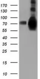 Anti-HSPA6 antibody [1H3] used in Western Blot (WB). GTX84333