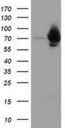 Anti-HSPA6 antibody [2C2] used in Western Blot (WB). GTX84335