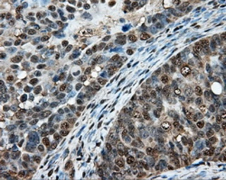 Anti-Hsp70 antibody [1B2] used in IHC (Paraffin sections) (IHC-P). GTX84337
