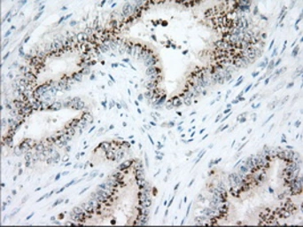 Anti-Hsp70 antibody [3C6] used in IHC (Paraffin sections) (IHC-P). GTX84338