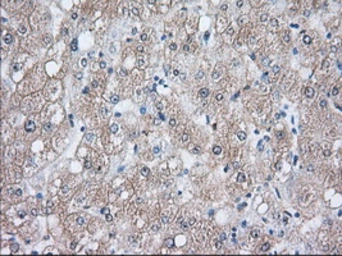 Anti-Hsp70 antibody [3C6] used in IHC (Paraffin sections) (IHC-P). GTX84338