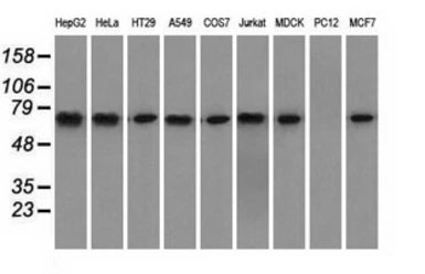 Anti-Hsp70 antibody [3C6] used in Western Blot (WB). GTX84338