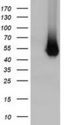 Anti-Haptoglobin antibody [1B1] used in Western Blot (WB). GTX84351