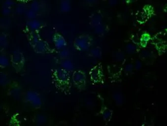 Anti-HIBCH antibody [1C7] used in Immunocytochemistry/ Immunofluorescence (ICC/IF). GTX84362