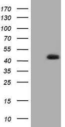 Anti-HIBCH antibody [1C7] used in Western Blot (WB). GTX84362