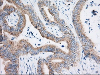 Anti-HIBCH antibody [3H5] used in IHC (Paraffin sections) (IHC-P). GTX84364