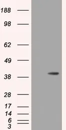 Anti-HIBCH antibody [3H5] used in Western Blot (WB). GTX84364